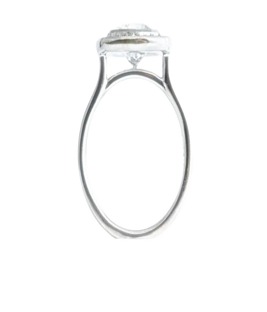 Ring Shank Repair
